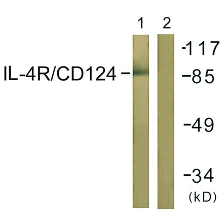 Western Blot - Anti-IL-4RAntibody (B1064) - Antibodies.com