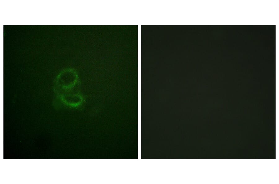 Immunofluorescence - Anti-IL-4RAntibody (B1064) - Antibodies.com