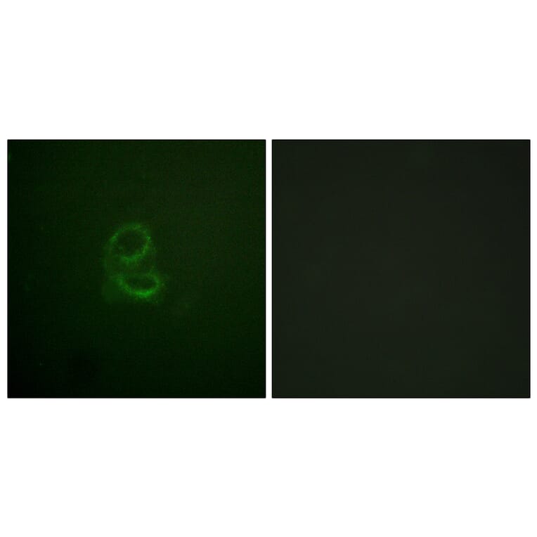 Immunofluorescence - Anti-IL-4RAntibody (B1064) - Antibodies.com