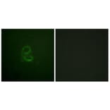 Immunofluorescence - Anti-IL-4RAntibody (B1064) - Antibodies.com