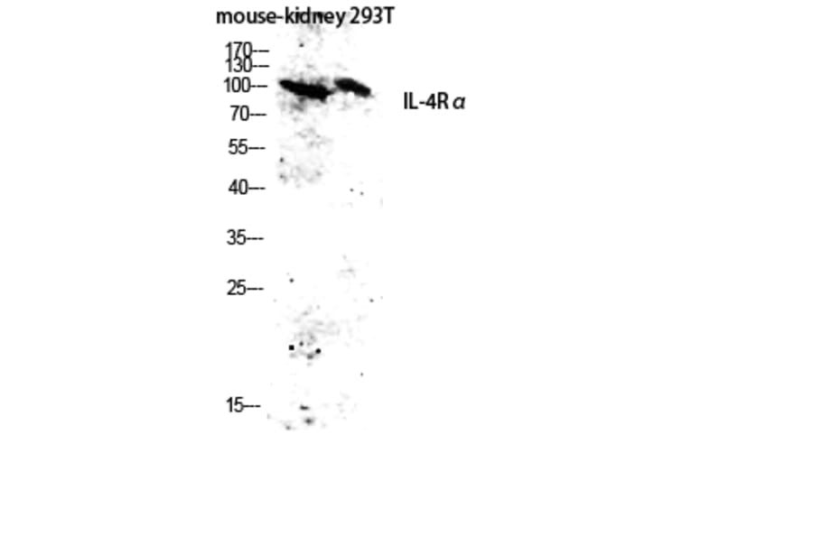Western Blot - Anti-IL-4RAntibody (B1064) - Antibodies.com