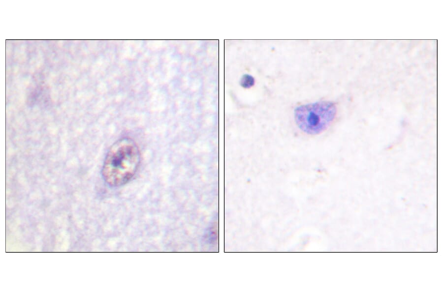 Immunohistochemistry - Anti-SP1 Antibody (B0577) - Antibodies.com