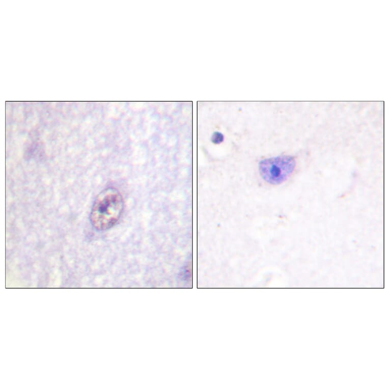 Immunohistochemistry - Anti-SP1 Antibody (B0577) - Antibodies.com