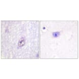 Immunohistochemistry - Anti-SP1 Antibody (B0577) - Antibodies.com
