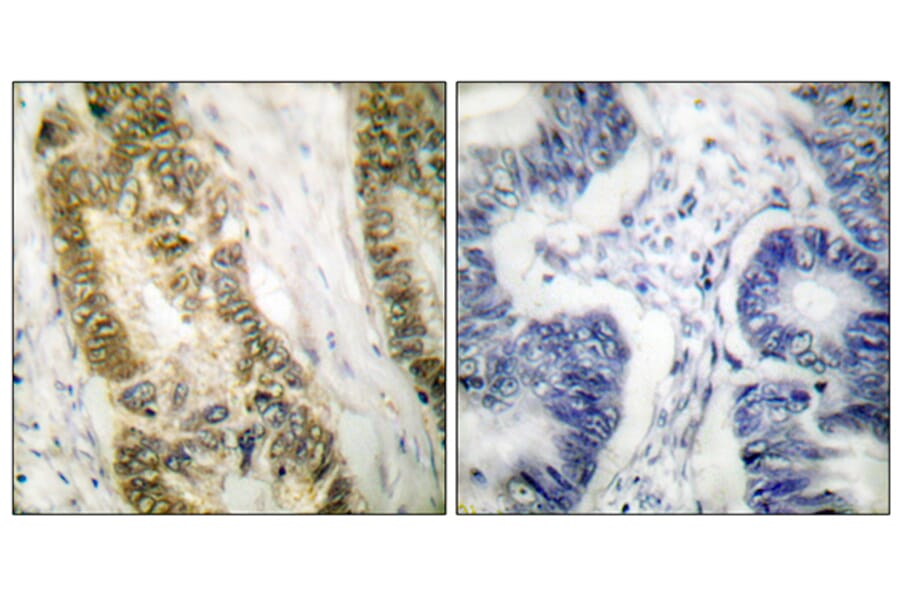 Immunohistochemistry - Anti-SP1 Antibody (B7218) - Antibodies.com