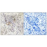 Immunohistochemistry - Anti-SP1 Antibody (B7218) - Antibodies.com