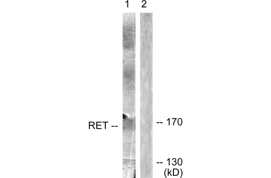 Western Blot - Anti-Ret Antibody (B0980) - Antibodies.com