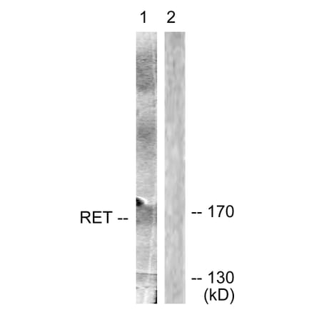 Western Blot - Anti-Ret Antibody (B0980) - Antibodies.com
