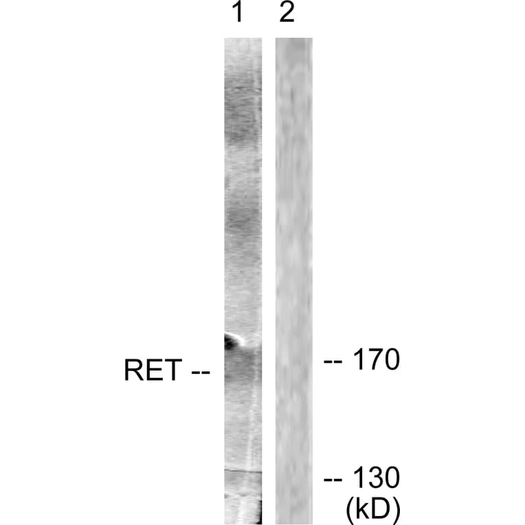 Western Blot - Anti-Ret Antibody (B0980) - Antibodies.com