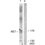 Western Blot - Anti-Ret Antibody (B0980) - Antibodies.com