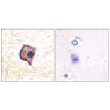 Immunohistochemistry - Anti-Ret Antibody (B0980) - Antibodies.com