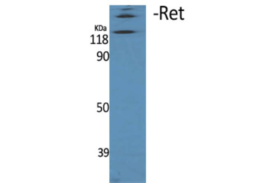 Western Blot - Anti-Ret Antibody (B0980) - Antibodies.com