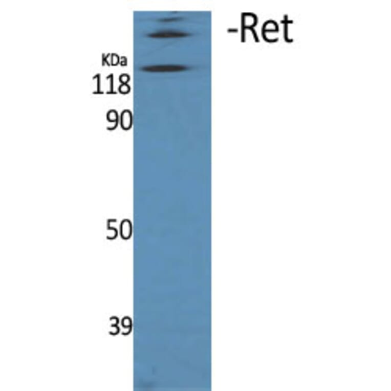 Western Blot - Anti-Ret Antibody (B0980) - Antibodies.com