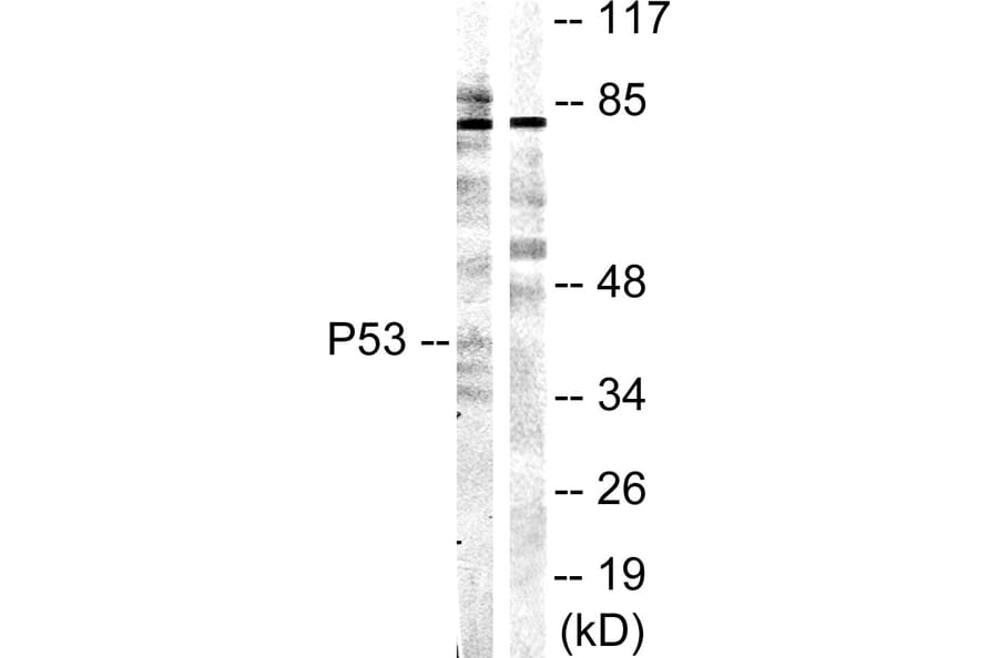 Western Blot - Anti-p53 Antibody (B0529) - Antibodies.com