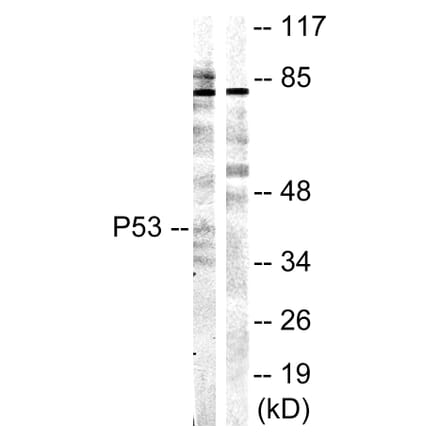 Western Blot - Anti-p53 Antibody (B0529) - Antibodies.com
