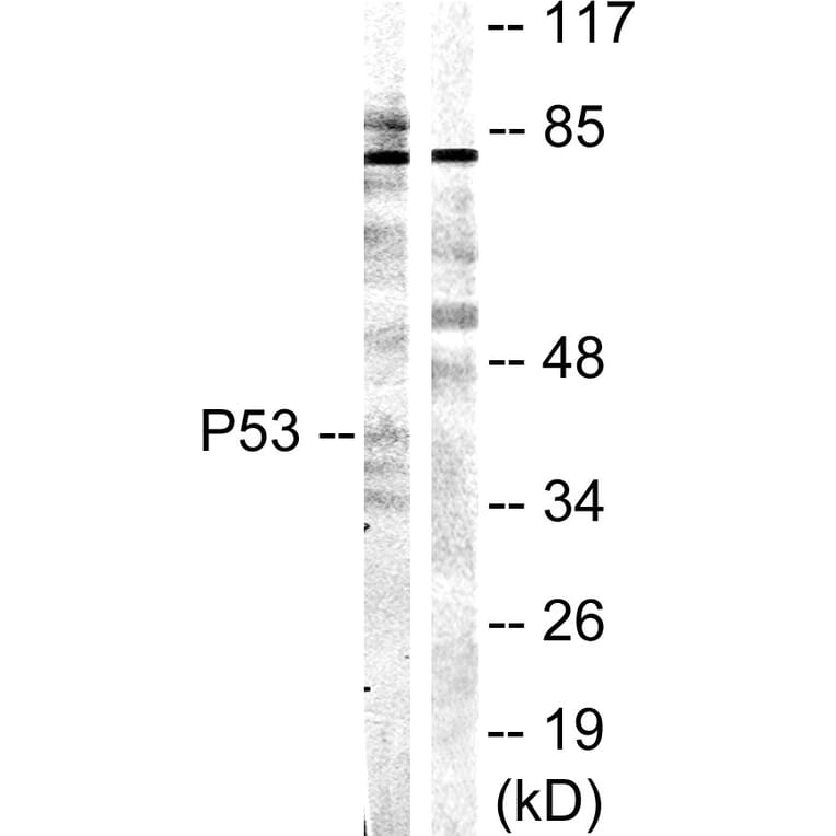 Western Blot - Anti-p53 Antibody (B0529) - Antibodies.com