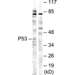 Western Blot - Anti-p53 Antibody (B0529) - Antibodies.com