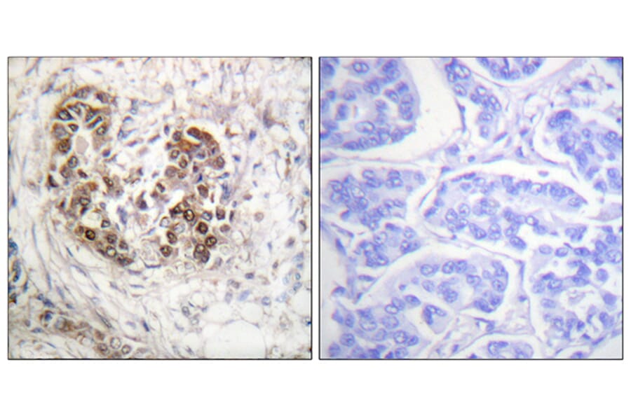 Immunohistochemistry - Anti-p53 Antibody (B0529) - Antibodies.com