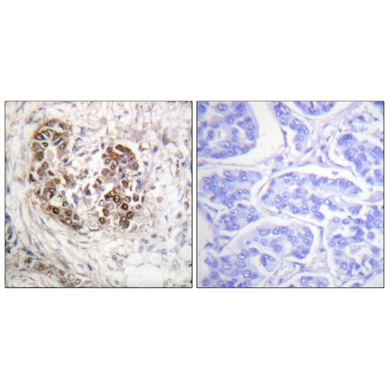 Immunohistochemistry - Anti-p53 Antibody (B0529) - Antibodies.com