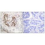 Immunohistochemistry - Anti-p53 Antibody (B0529) - Antibodies.com
