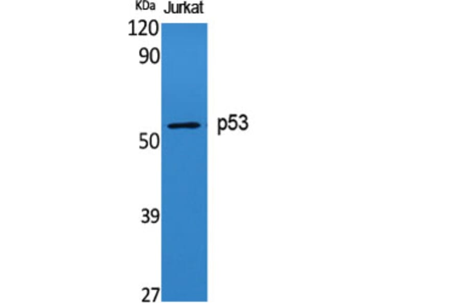 Western Blot - Anti-p53 Antibody (B0529) - Antibodies.com