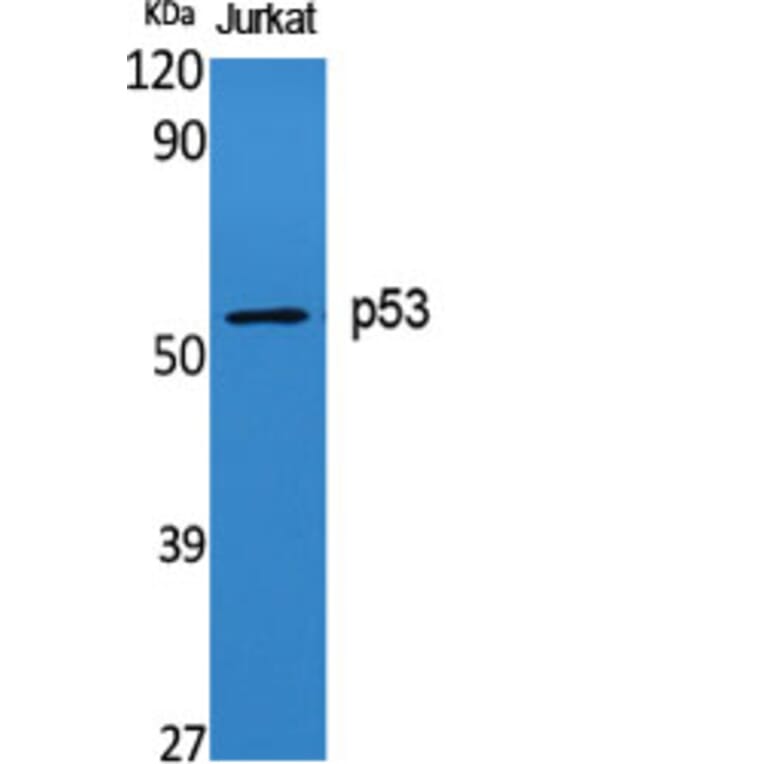 Western Blot - Anti-p53 Antibody (B0529) - Antibodies.com