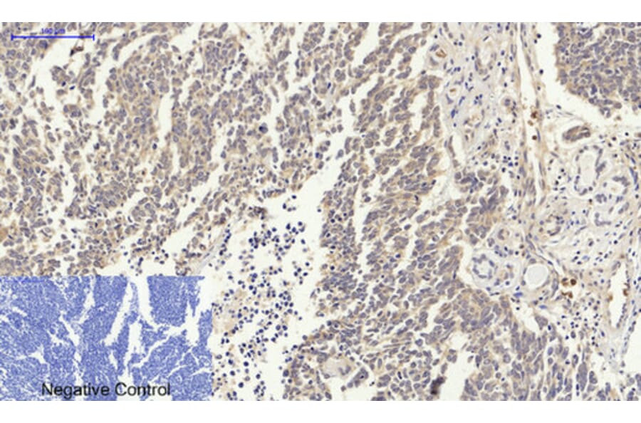 Immunohistochemistry - Anti-p53 Antibody (B0529) - Antibodies.com