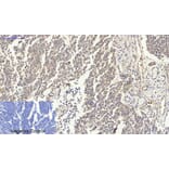 Immunohistochemistry - Anti-p53 Antibody (B0529) - Antibodies.com