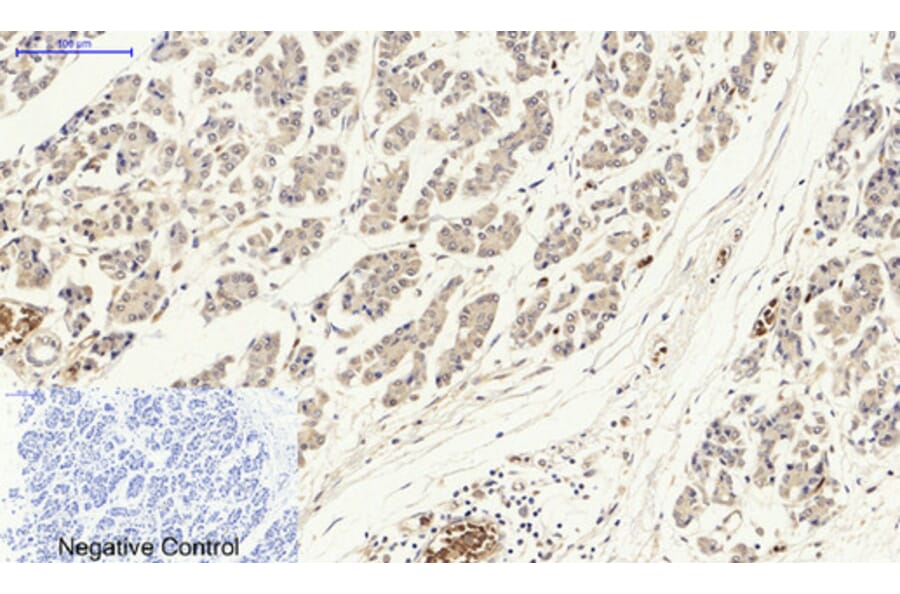 Immunohistochemistry - Anti-p53 Antibody (B0529) - Antibodies.com