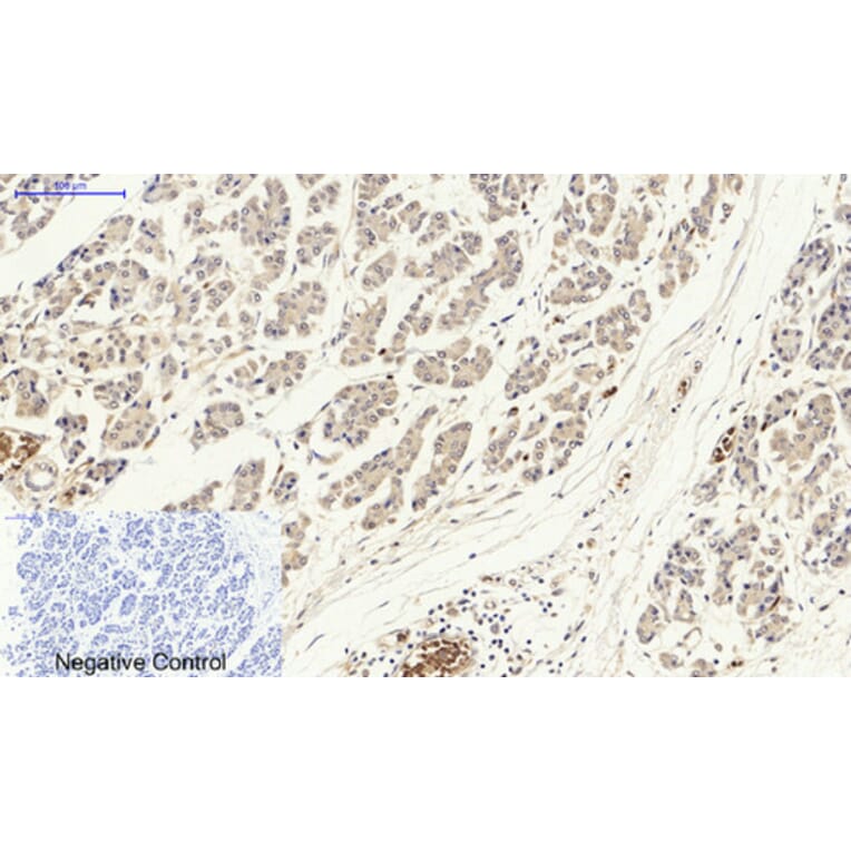 Immunohistochemistry - Anti-p53 Antibody (B0529) - Antibodies.com