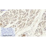 Immunohistochemistry - Anti-p53 Antibody (B0529) - Antibodies.com