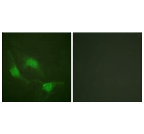 Immunofluorescence - Anti-p53 Antibody (D0037) - Antibodies.com