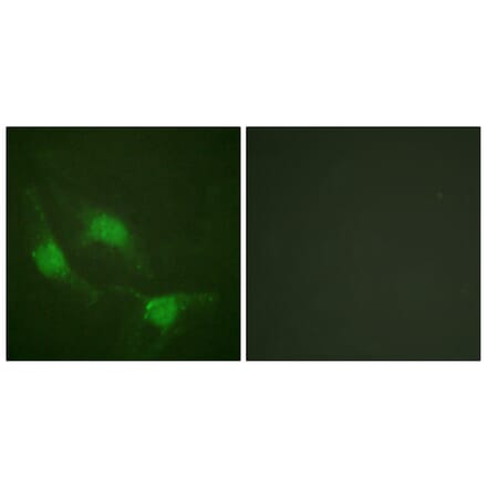 Immunofluorescence - Anti-p53 Antibody (D0037) - Antibodies.com