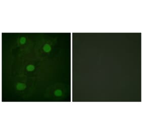 Immunofluorescence - Anti-p53 Antibody (D0035) - Antibodies.com