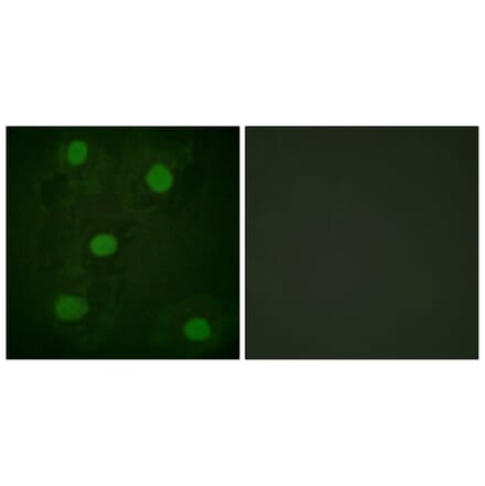 Immunofluorescence - Anti-p53 Antibody (D0035) - Antibodies.com