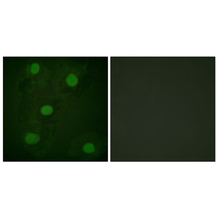 Immunofluorescence - Anti-p53 Antibody (D0035) - Antibodies.com