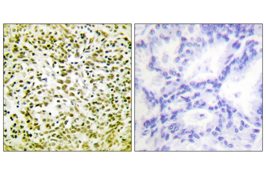Immunohistochemistry - Anti-p53 Antibody (D0035) - Antibodies.com
