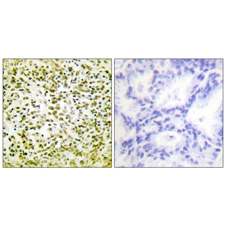 Immunohistochemistry - Anti-p53 Antibody (D0035) - Antibodies.com