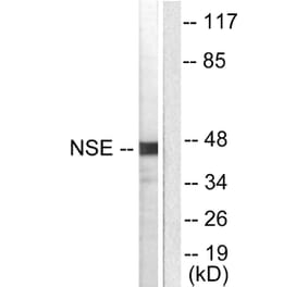 Western Blot - Anti-NSE Antibody (C0280) - Antibodies.com