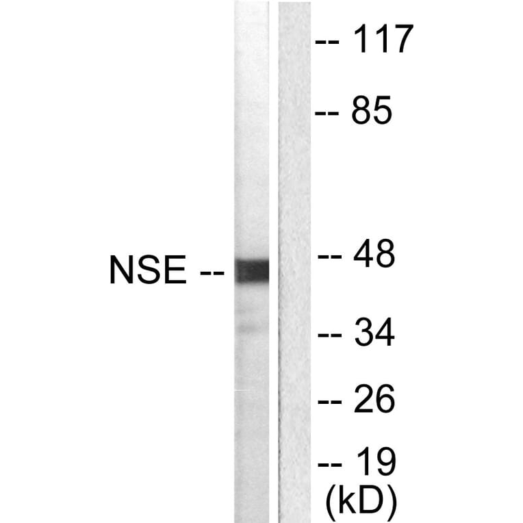 Western Blot - Anti-NSE Antibody (C0280) - Antibodies.com