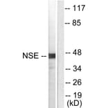 Western Blot - Anti-NSE Antibody (C0280) - Antibodies.com