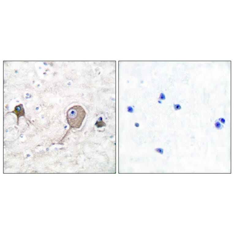 Immunohistochemistry - Anti-NSE Antibody (C0280) - Antibodies.com