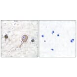 Immunohistochemistry - Anti-NSE Antibody (C0280) - Antibodies.com