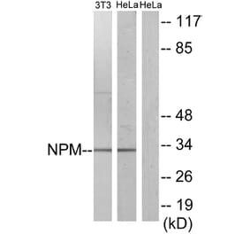 Western Blot - Anti-NPM Antibody (B1166) - Antibodies.com