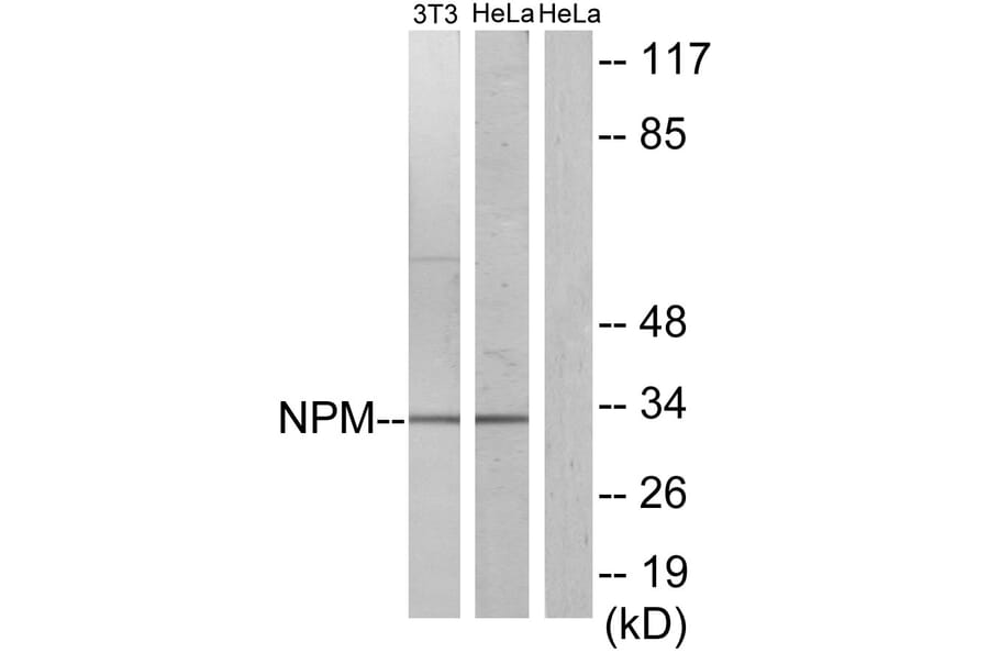 Western Blot - Anti-NPM Antibody (B1166) - Antibodies.com