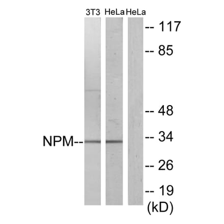 Western Blot - Anti-NPM Antibody (B1166) - Antibodies.com
