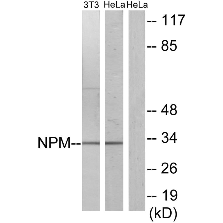 Western Blot - Anti-NPM Antibody (B1166) - Antibodies.com