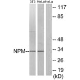 Western Blot - Anti-NPM Antibody (B1166) - Antibodies.com
