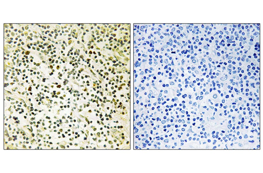 Immunohistochemistry - Anti-NPM Antibody (B1166) - Antibodies.com