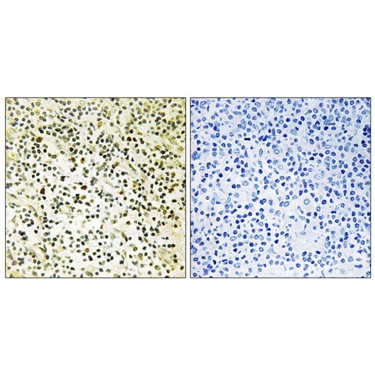 Immunohistochemistry - Anti-NPM Antibody (B1166) - Antibodies.com